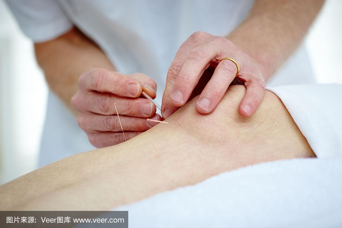 在病人的膝盖上做针灸的理疗师