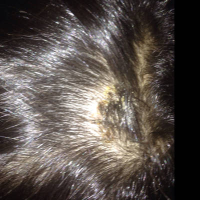 女儿头上长了一个痤疮,怎麼办,开始不小心拨掉了,流水出来了,后天过了