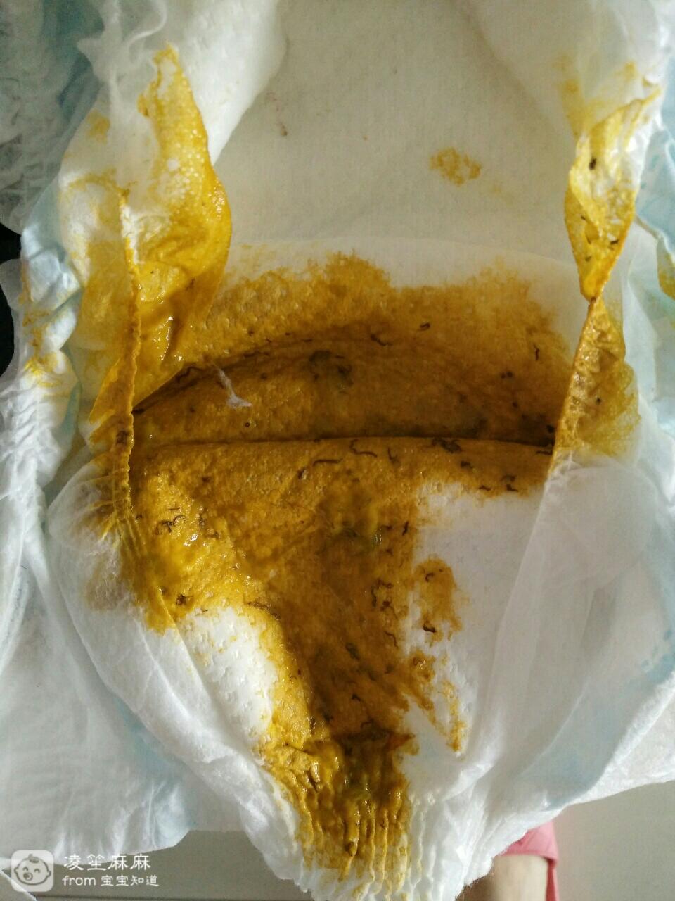 各位宝妈看看,宝宝的大便里有这些黑色线状物,是什么东西?