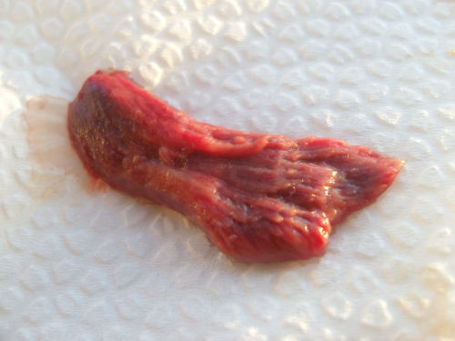 经期从阴道掉出一块肉,是什么东西?