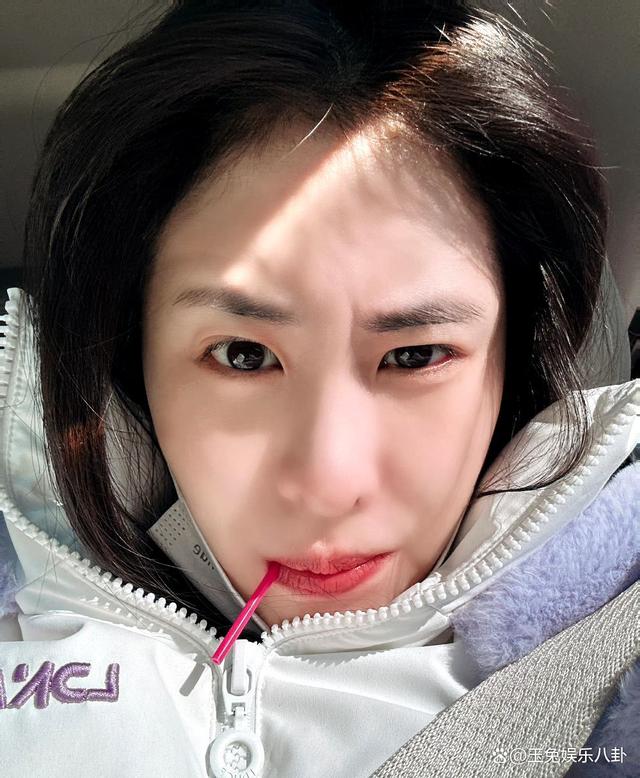 张碧晨被质疑整容,34岁张碧晨素颜照鼻孔大小不对称牙齿龅牙怪异