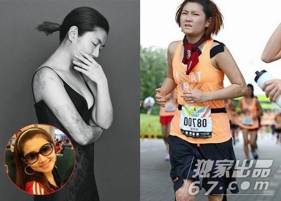 selina大方展露烧伤疤 网友动容