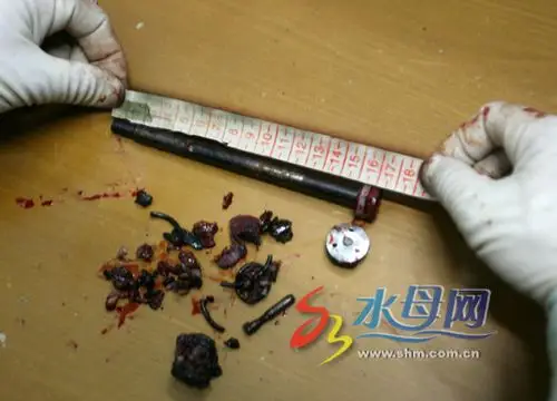 办公椅突然爆炸14岁少年菊花被暴不治身亡你办公室是什么椅子