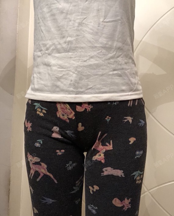 三个月了,腰部左右有些不对称[:5]疤痕还在,什么_圈子-新氧美容整形