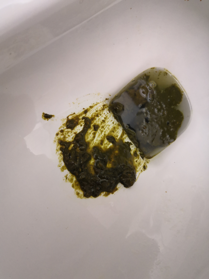 从你身体里出来的最恶心的东西是什么!