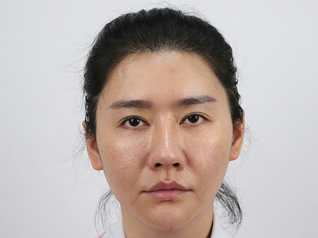 泪沟法令纹干纹细纹