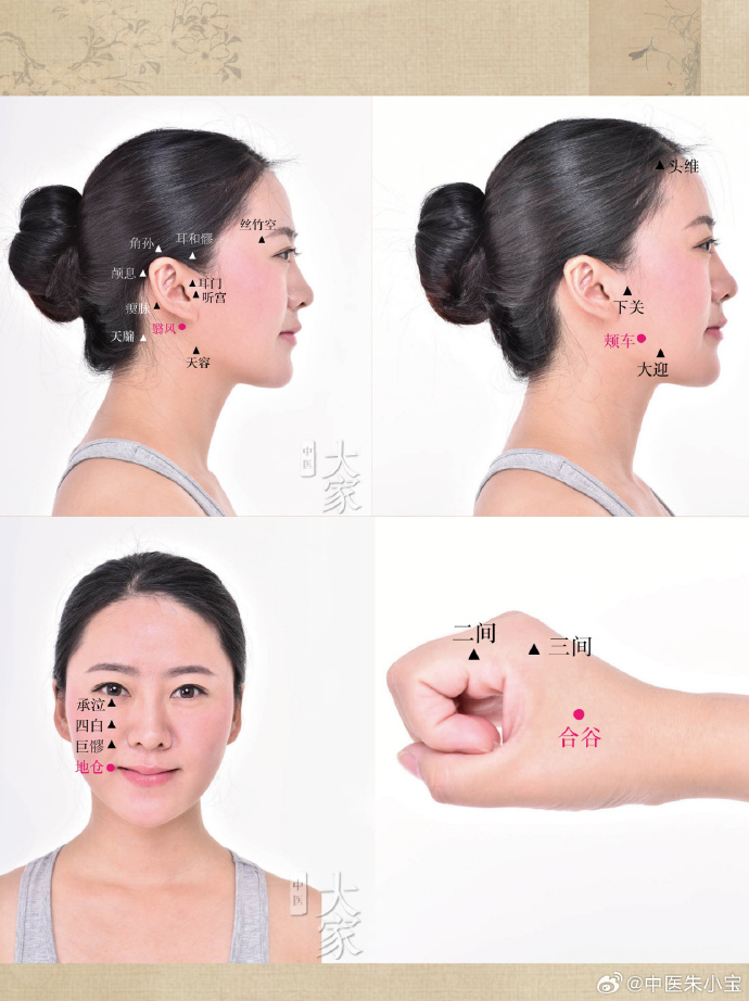 「针灸实战经验」面瘫的针灸治疗丨针法实战篇-1面瘫的针灸治疗重在