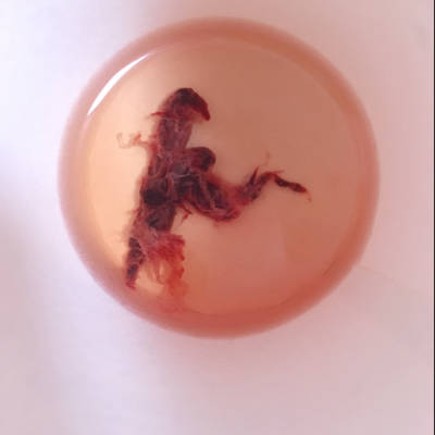 怀孕44天,流了4天血,大家看看这个是孕囊吗?