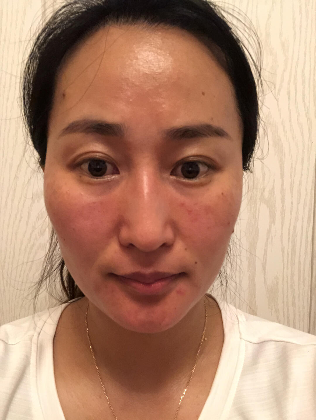 虽然皮肤状态不好～我还是去运动了～只是为了让自己提高免疫力～我就