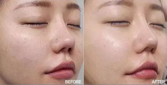 使用ag面膜的前后对比图