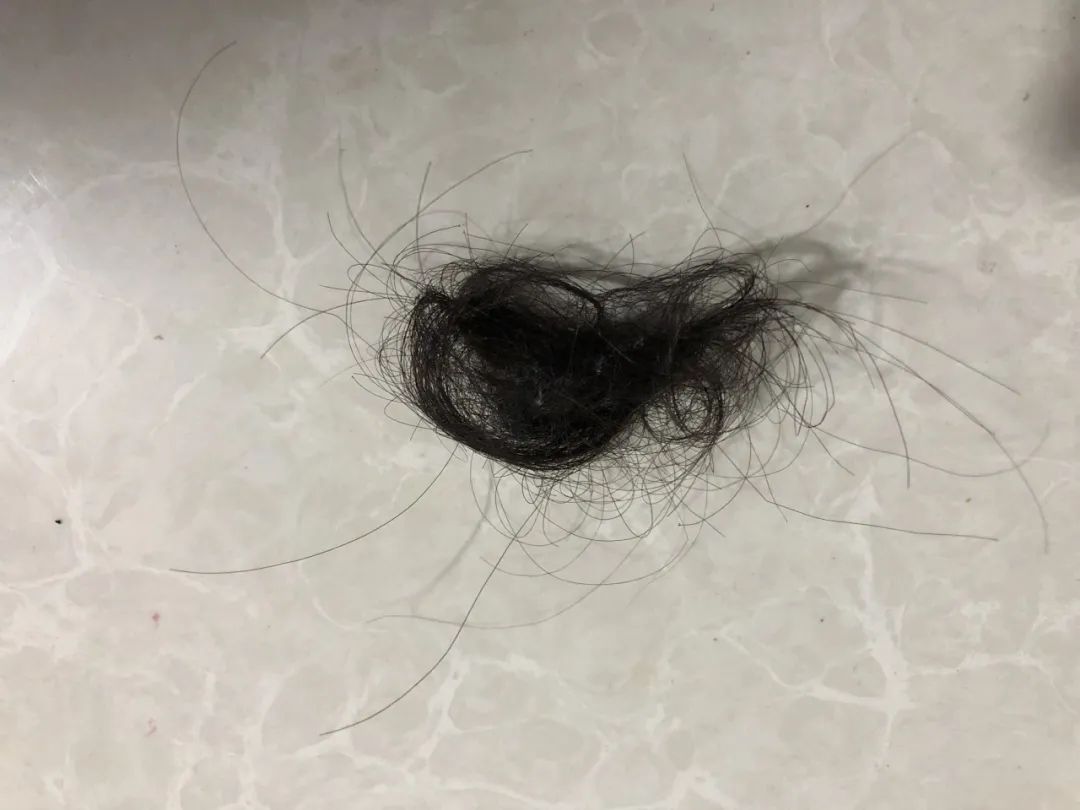 拿起了菜刀骑在我的身上打我头抓我的头发