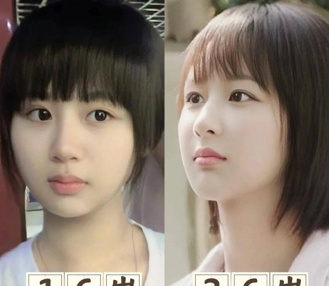 杨紫到底有没有整容?网友直言:敢做不敢认?_事情_女明星_照片
