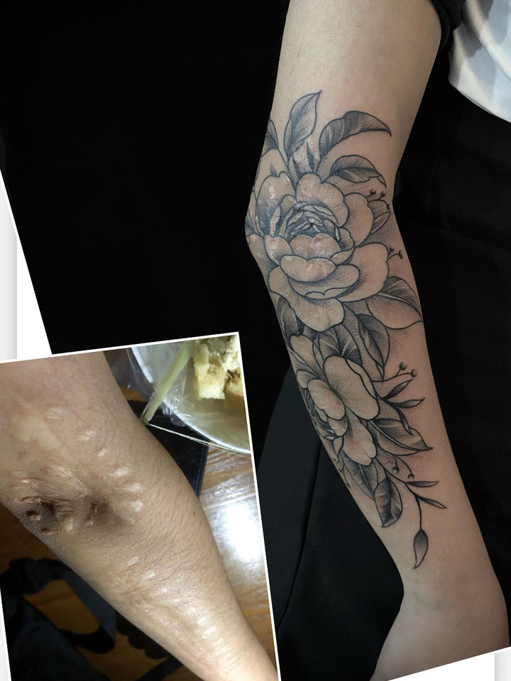 素花遮盖疤痕_纹身图案手稿图片_赵泽涵的纹身作品集