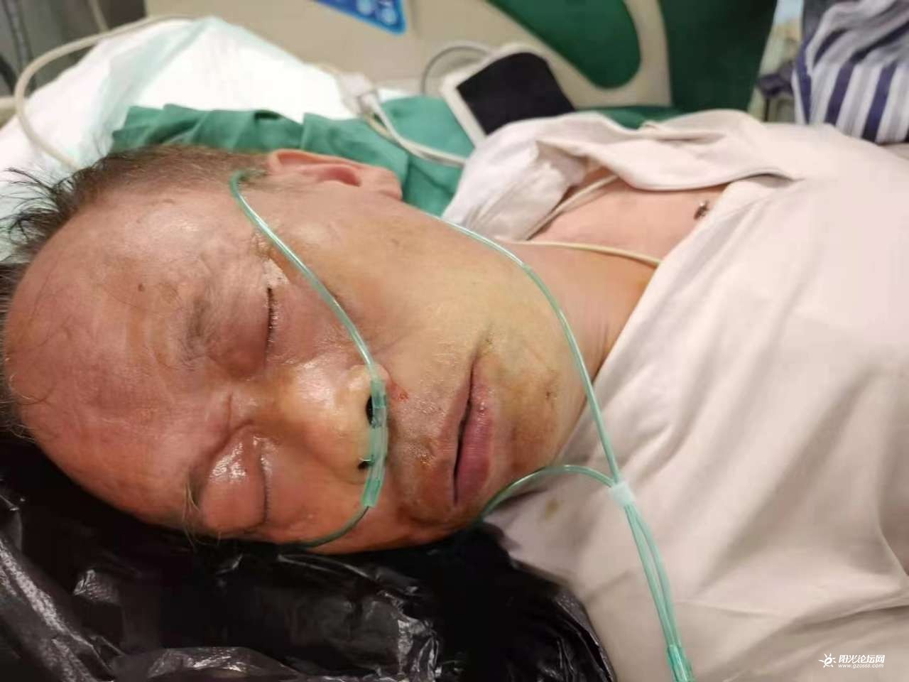 【紧急寻找家属】高州瀛洲公园一大叔不省人事,已送医院