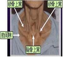 第一章 呼吸系统疾病病人的护理