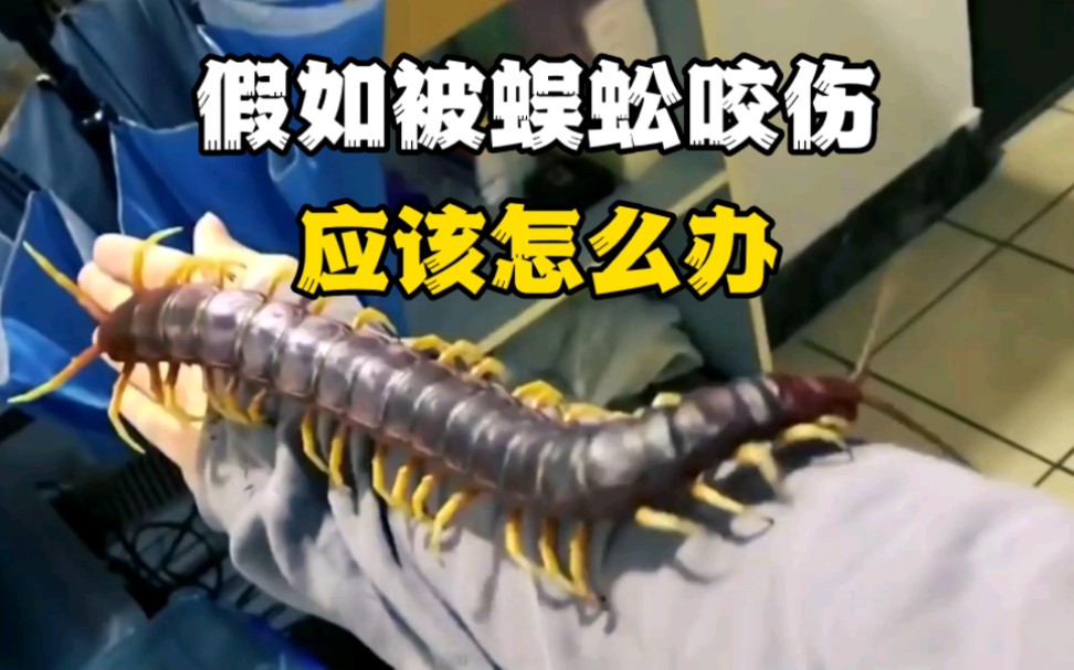 假如被蜈蚣咬伤应该怎么办?