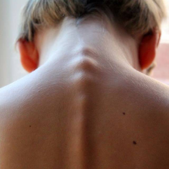 【致敬首届中国医师节】关爱少年儿童脊柱健康,我们来了!