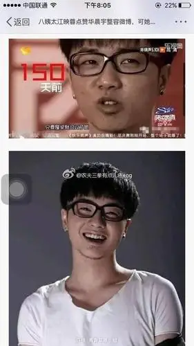 华晨宇是整容了吗以前不长现在这样啊脸上好多痘坑