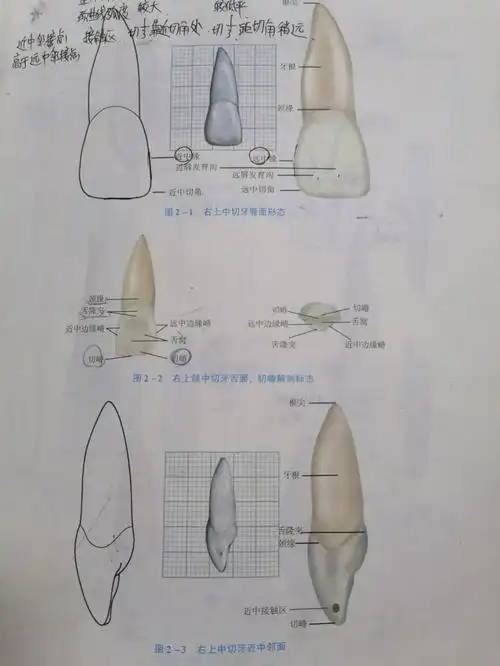温习牙体解剖之上下1和上下3