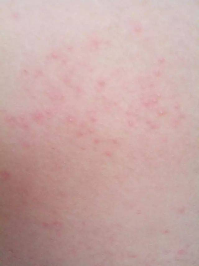 皮肤来说,就像个保护膜,你搓那么狠,都发红带疼的,角质层能不遭到破坏