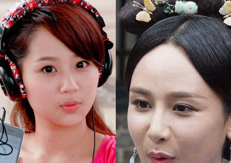 杨紫打扮神秘现身整形医院被质疑整容曾数度否认称是角度问题