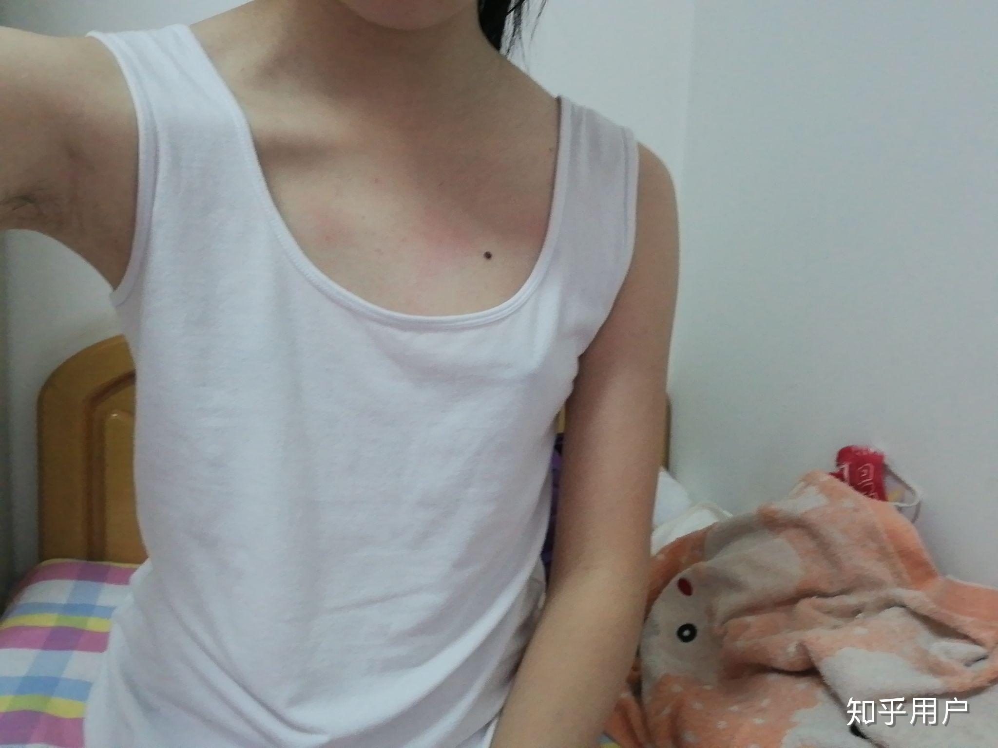 23岁了胸部完全不发育,我这辈子还能恋爱,结婚吗? - 知乎