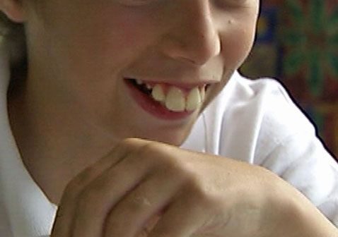 龅牙图片真人图片