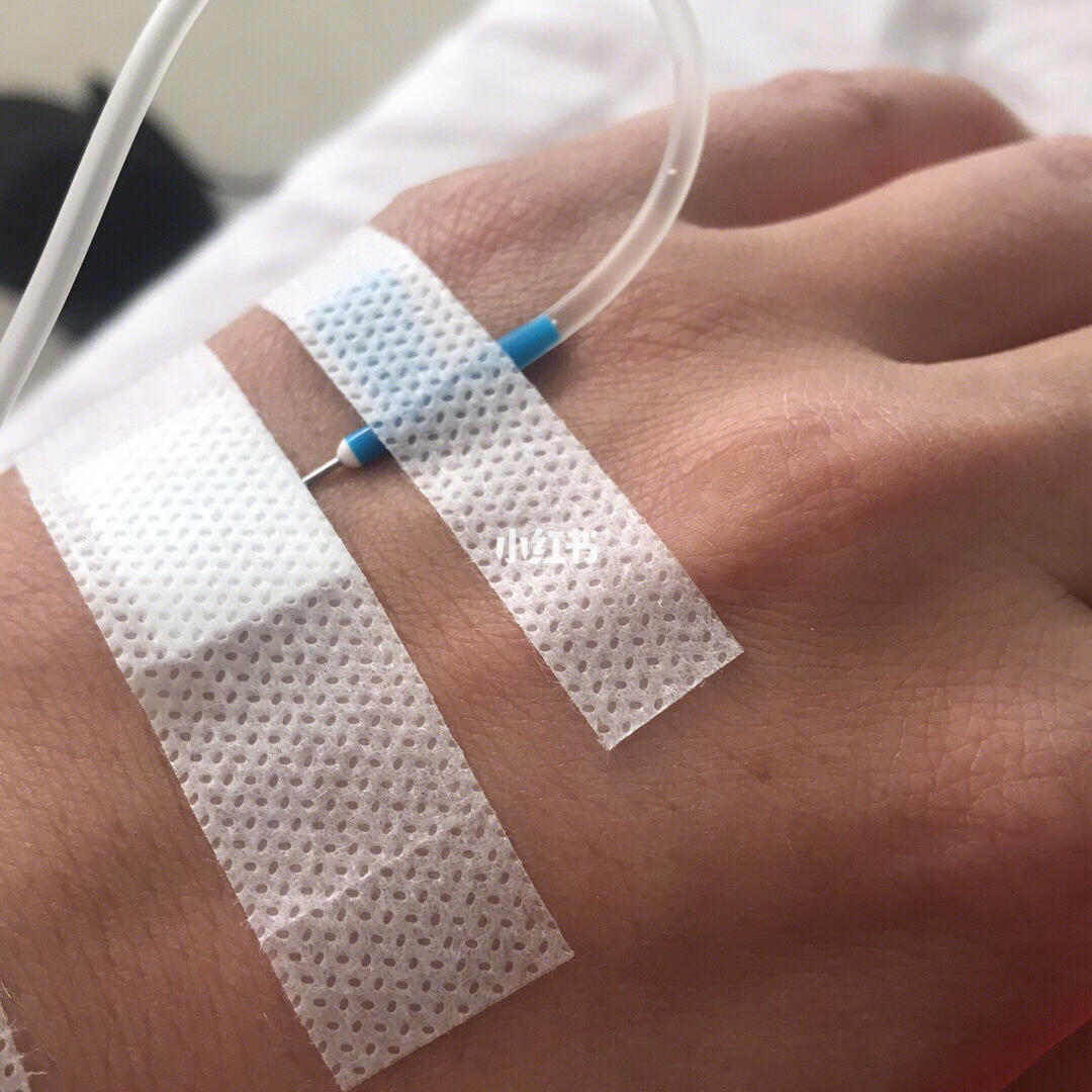 没忍住,输液来了～孕吐第8天,瘦了14斤,输液3天,每天4斤水都不想上