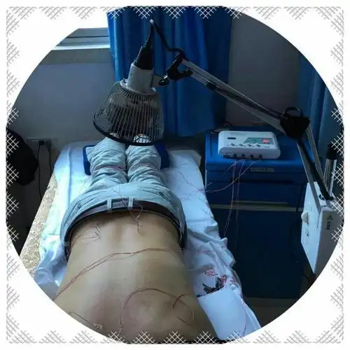腰痛患者在接受针灸治疗