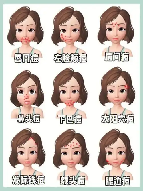 脸上不同位置长痘原因脸上的不同部位长痘