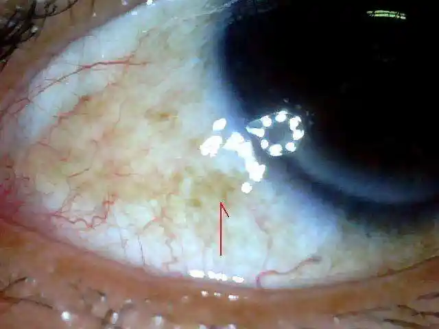 黄)综合上述,我们的身体不会欺骗我们,当我们肝脏开始有问题时,肝病会