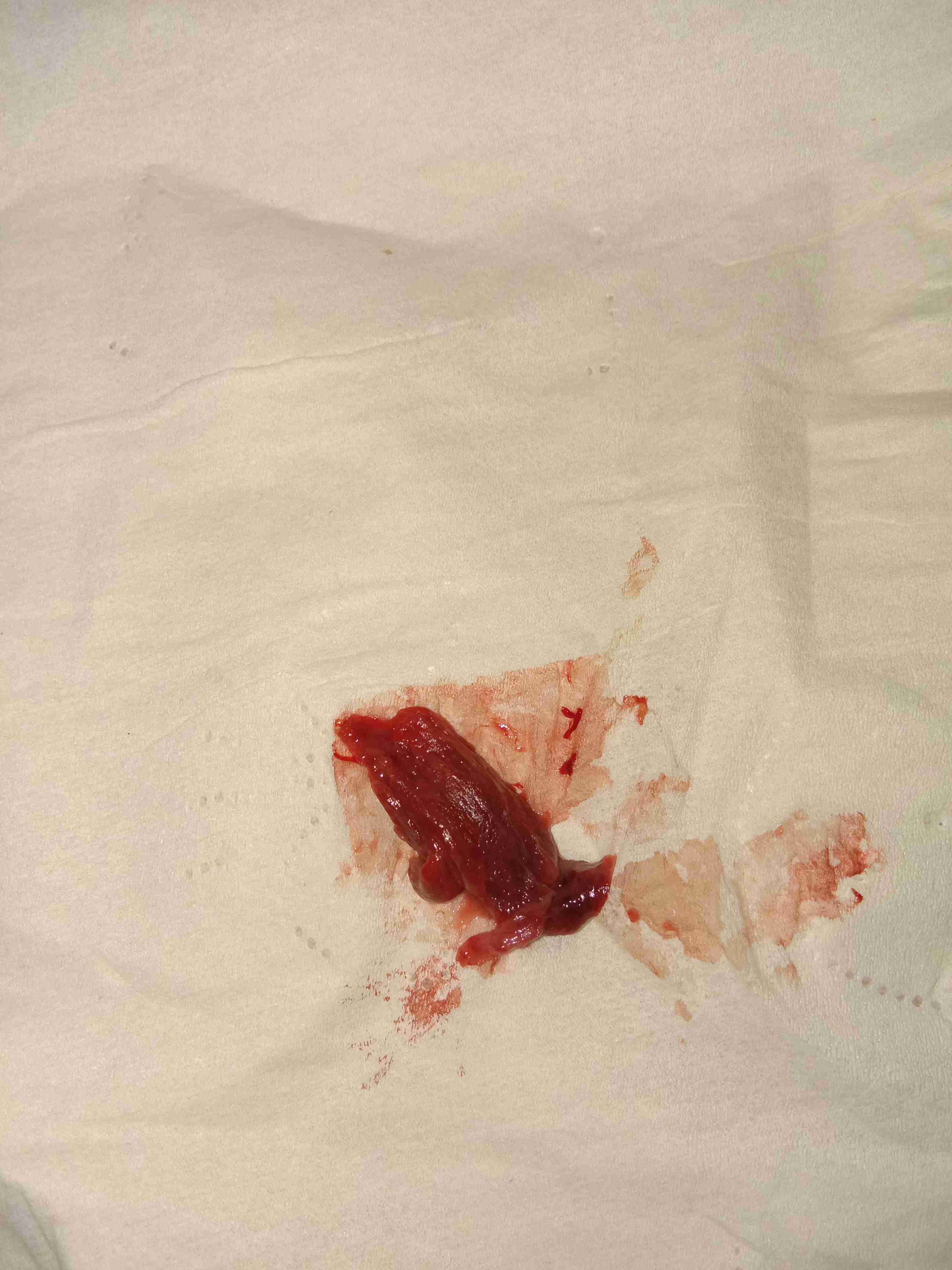 今天下午来例假的时候,出现一块肉是怎么回事啊?有没有知道的?