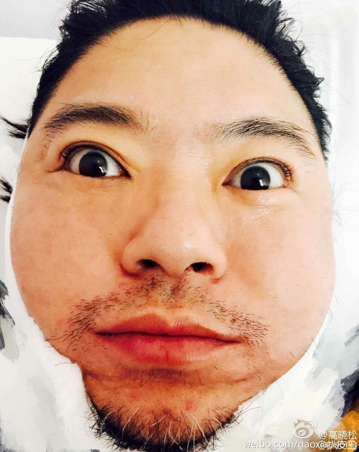 为什么长得丑还爱自拍?