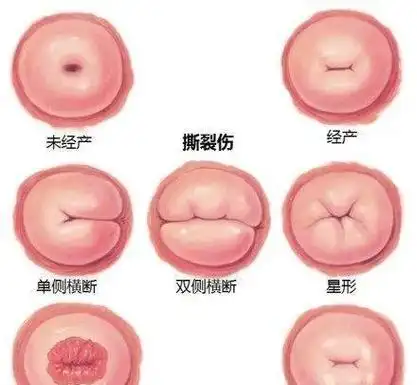 医生:3个地方瞒不了人|流产|子宫|怀孕|胎儿|手术_网易订阅