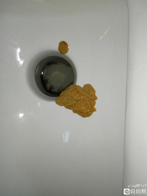 大便老是拉稀怎么回事(天天上厕所拉稀怎么回事)_竞价网