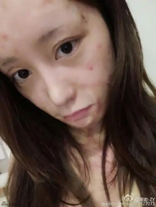 烧伤女孩周岩旧照甜美清纯 性格坚强阳光