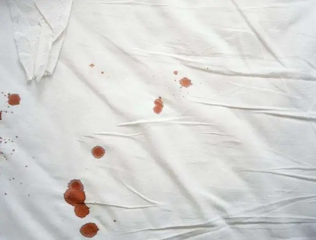 上完厕所看内裤医生3种异常分泌物警惕子宫病变