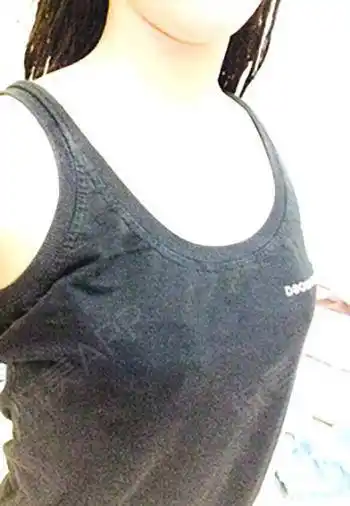 假体隆胸手术当天_隆胸手术当天_胸部整形手术当天_梦の印记分享图片3