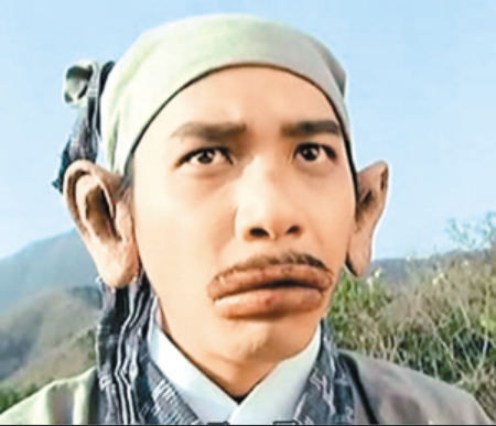 男子一发病就变成欧阳锋嘴肿得像香肠眼睛肿得像气球