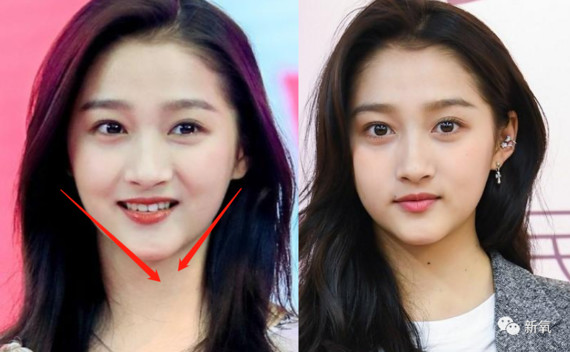 为什么人人都骂关晓彤土,却没人注意她长了一张挑不出错的脸?