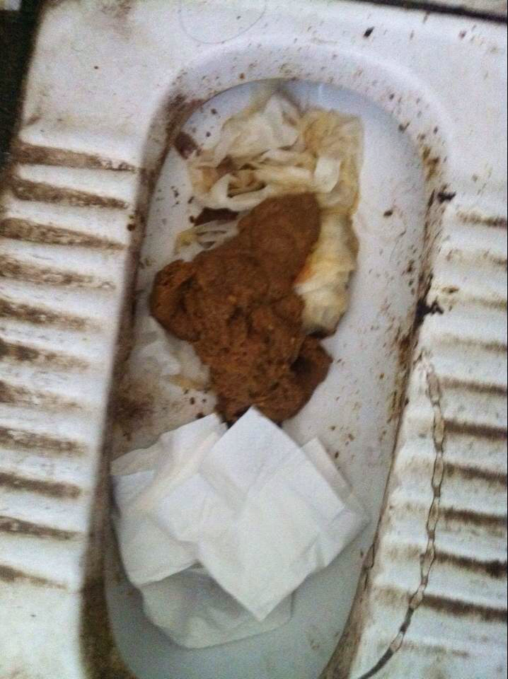 请问下医生我这大便健康吗