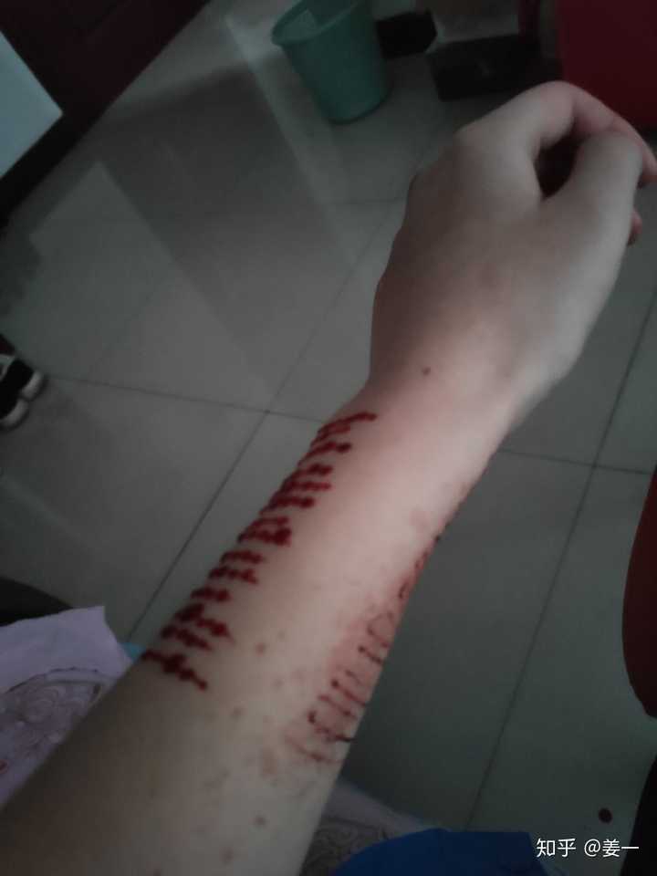 自残的人真的很令人讨厌吗?