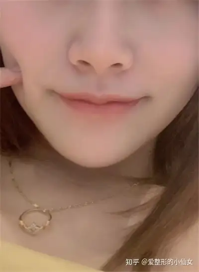 想要好看薄唇做个厚唇改薄就能变美啦