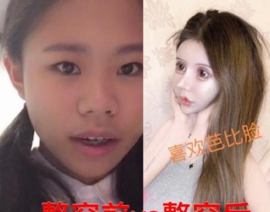 女网红13岁开始整容整容60次花100万大家表示还不如不整