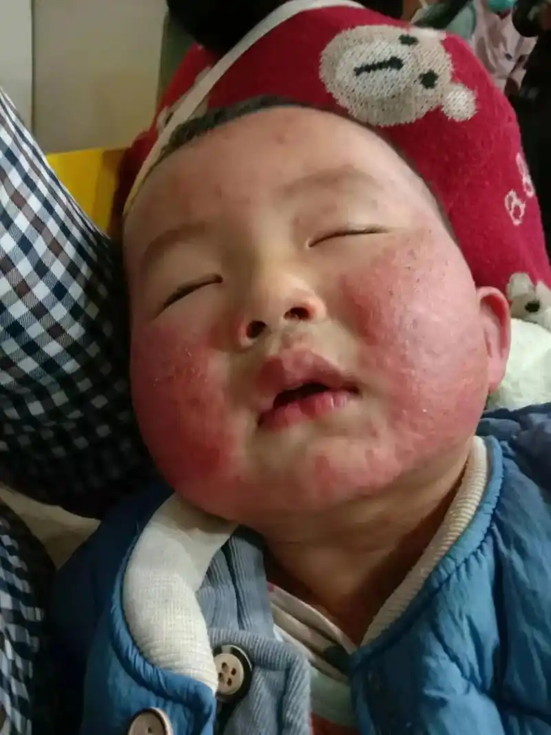 我也是一个宝妈,给孩子王平台上买了口罩,宝宝脸就变成这样了, - 抖音