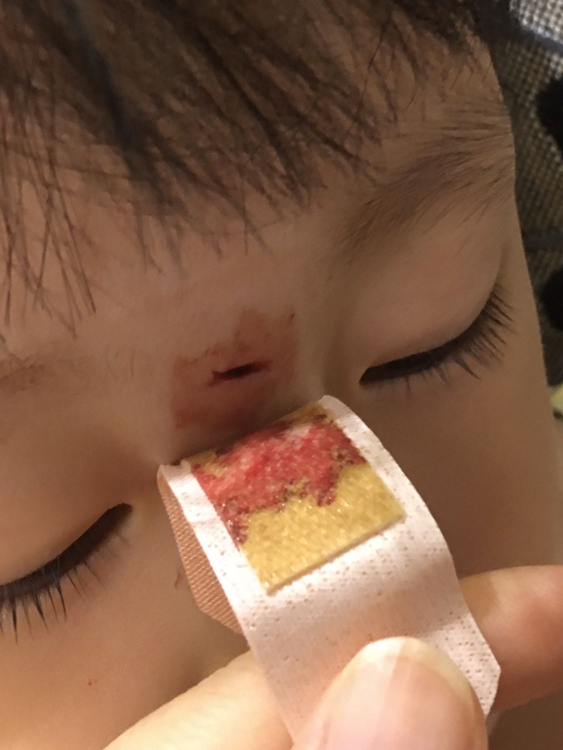 问:孩子三岁半,头磕破了,伤口看着挺深,需要打破伤风么?