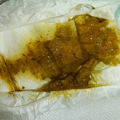 宝宝最近喉咙有痰,吃了化痰的药,还吃了碳酸钙,拉