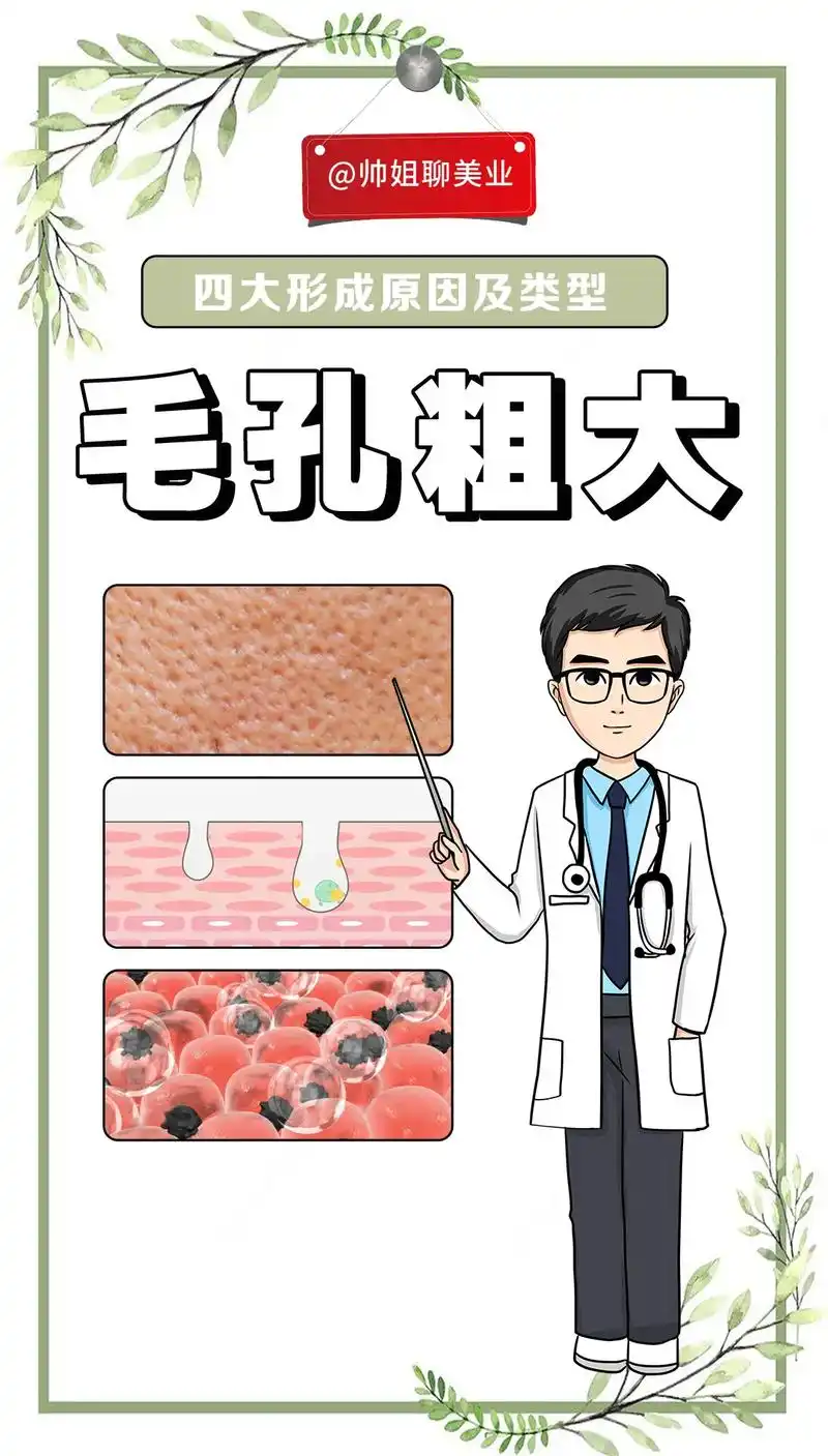 毛孔粗大的原因主要包括皮肤 - 抖音