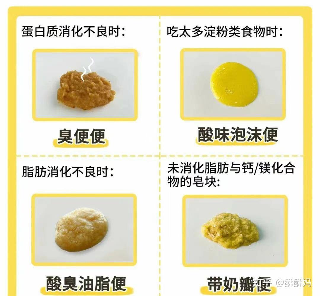 说完了不同时期正常的便便形态,那么接下来给大家说说其他常见形态的