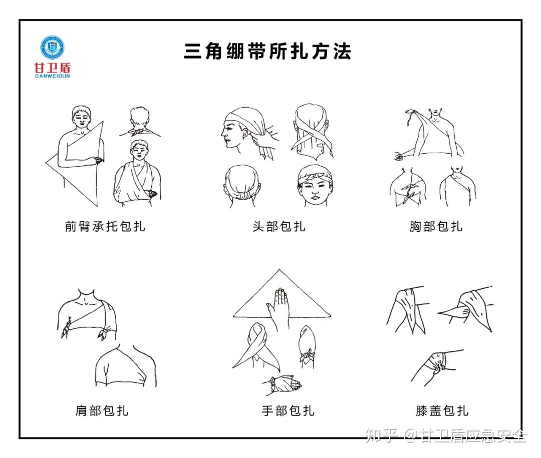 对较大创伤面,固定夹板,手臂悬吊等,需应用三角巾包扎法.